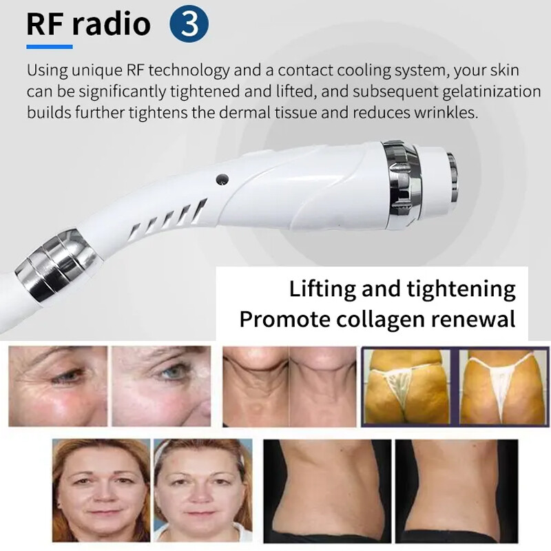 3IN1 ND YAG TATTOO REMOVAL IPL OPT Hair Removal Laser RF Skin Beauty Machine