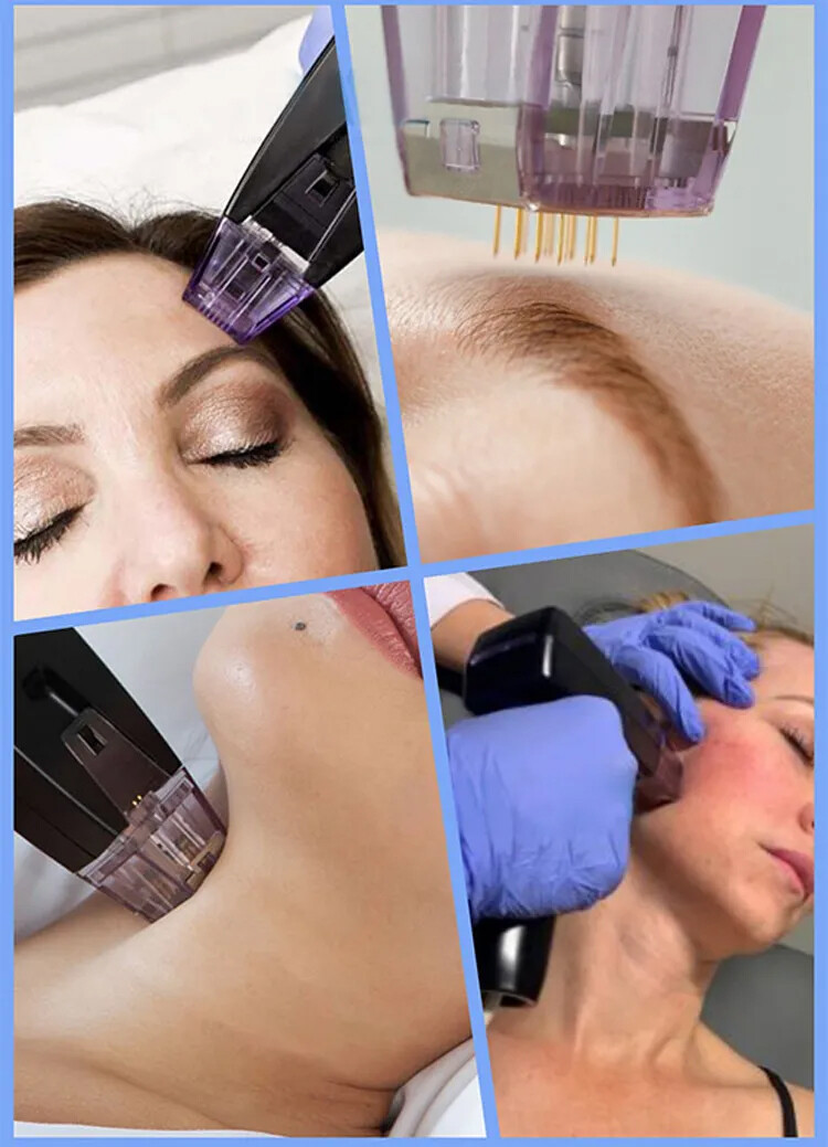 Facial Skin Tightening Mor pheus Wrinkle Removal Lifting RF Rejuvenation Machine