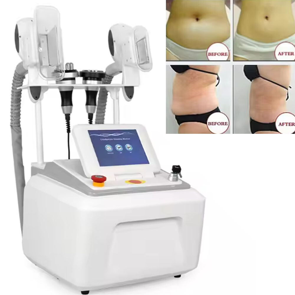 Partial Body Fat Reduction Cryo Slimming Freezing Fat Removal Shaping Machine