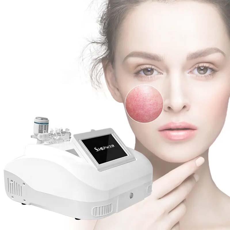 980nm Diode Laser Skin Rejuvenation Machine Spider Veins Facial Redness Reduce
