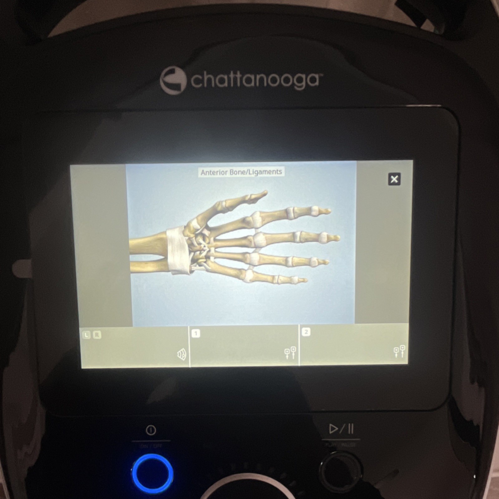 Chattanooga Intellect Legend 2 w/Cart. Touchscreen Ultrasound / E Stim System