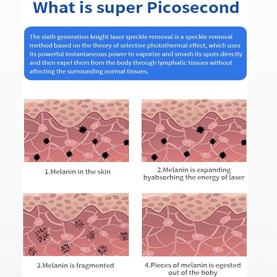 Professional Picosecond Laser for Tattoo Removal Skin Rejuvenation Resurfacing