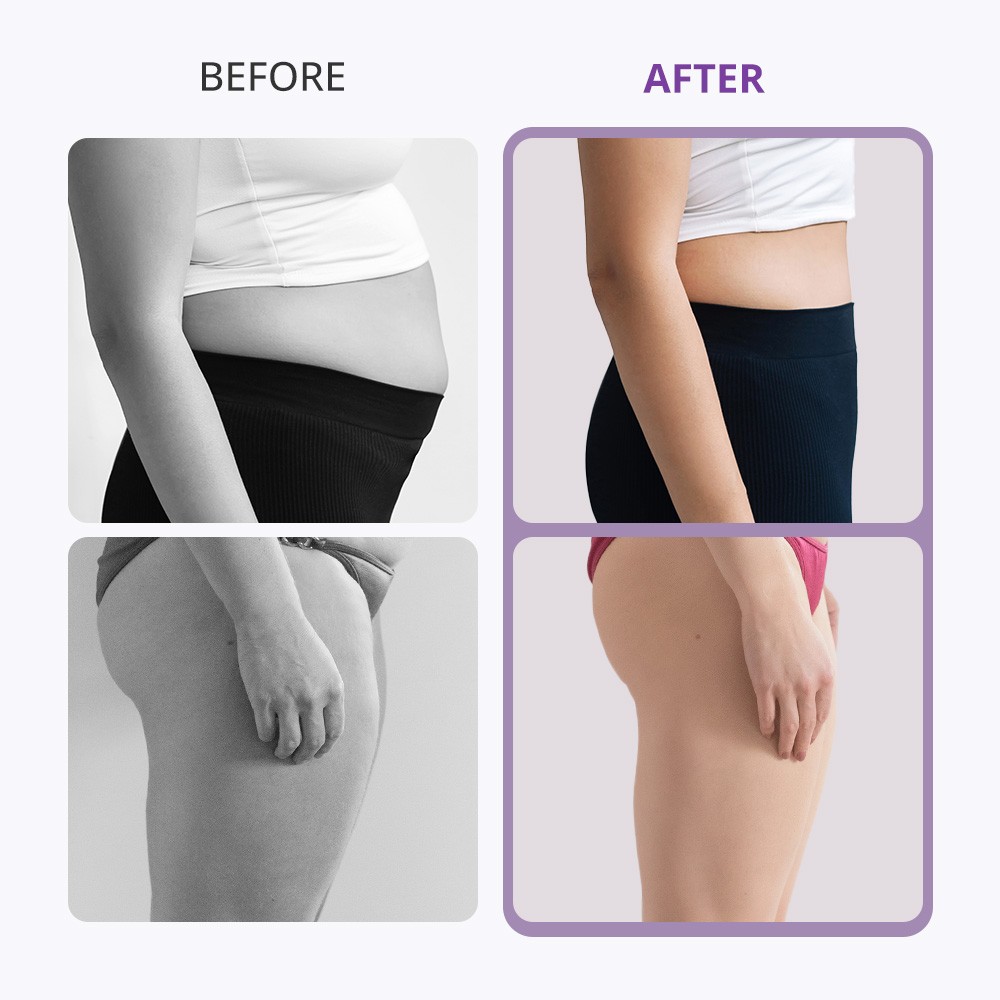 myChway 7in1 40-K Home & Beauty Salon Machine for Enhance Body Curves Skin Care