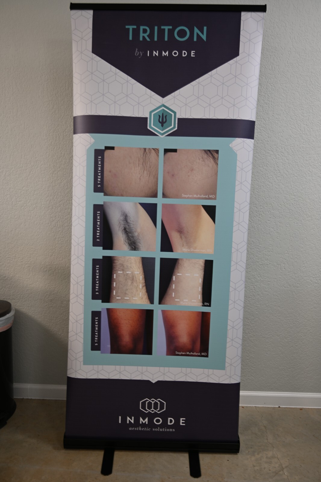 Promotional Retractable Banner Triton Inmode, Standup banner office Marketing