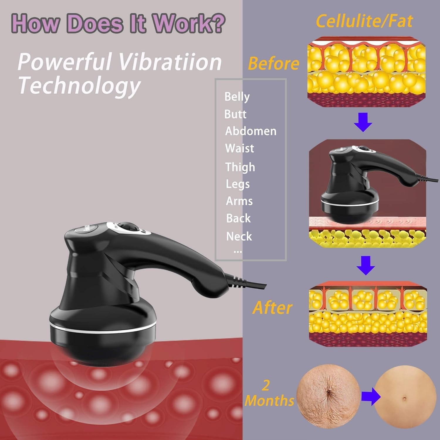 Electric Body Sculpting Device – Home Use for Belly & Thighs
