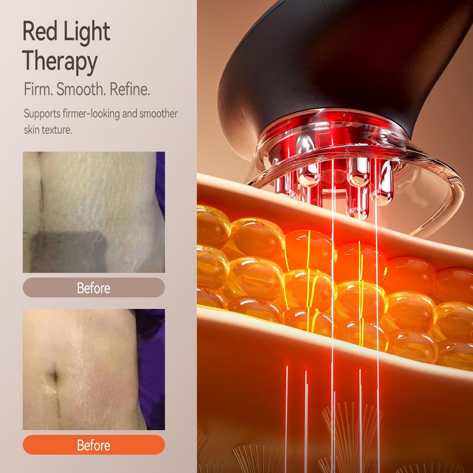 3-in-1 Body Sculpting Device – Red Light, Vacuum Suction & Microcurrent, Celluli