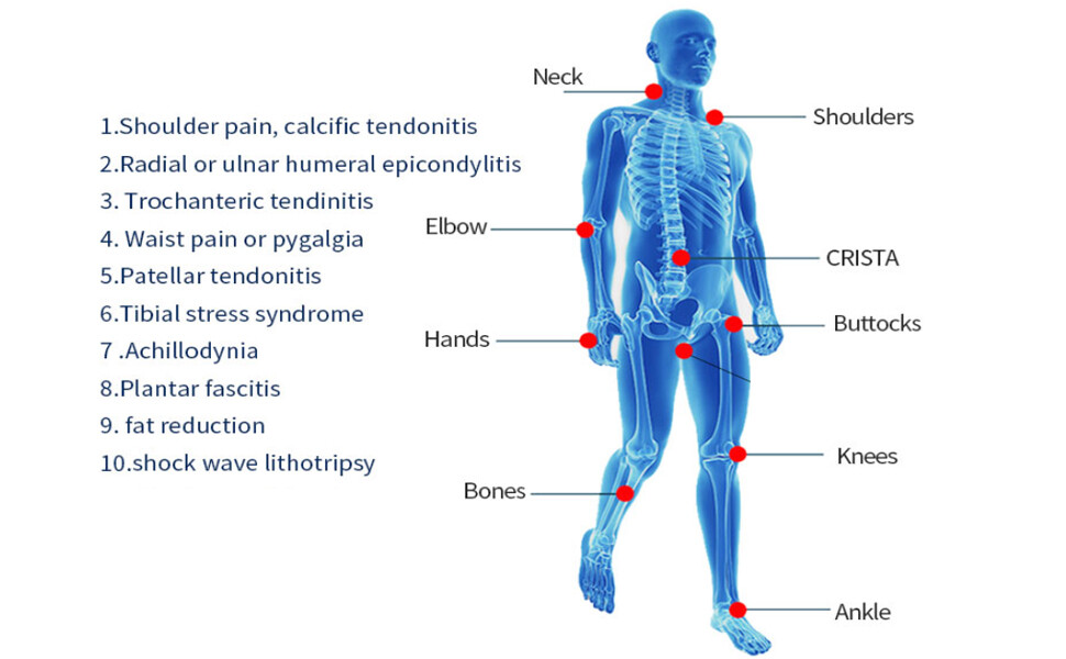 Shockwave Therapy Machine for Muscle & Shoulders Pain Relief ED Therapy Machine