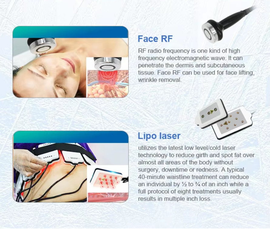 Fat Freezing Body Slimming Therapy Lipolysis Fat Removal Sculpt Spa Machine