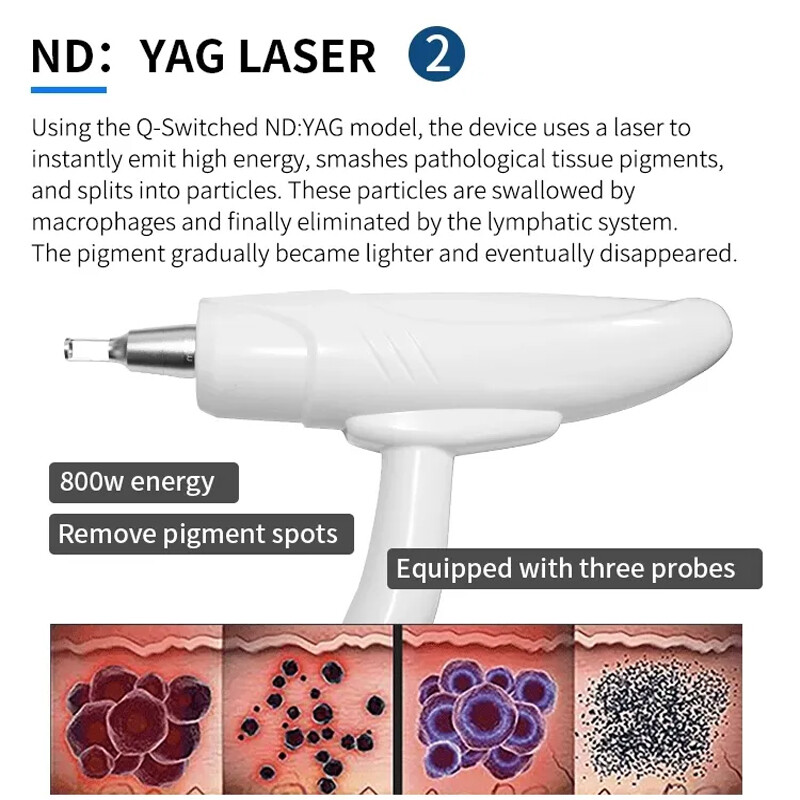 3IN1 ND YAG TATTOO REMOVAL IPL OPT Hair Removal Laser RF Skin Beauty Machine