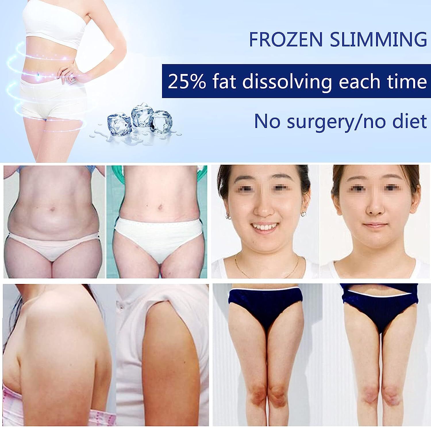Body Sculpting Cryo therapy Fat Freezing Machine Loss Weight Skin Tightening