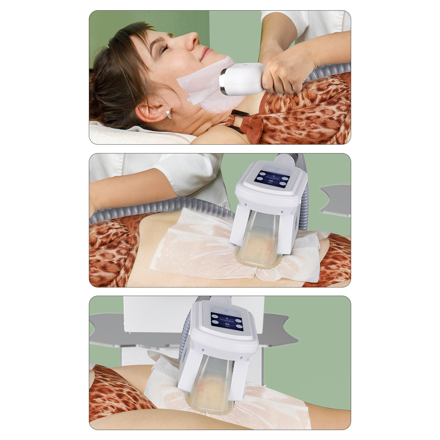 1/2/3 Handles Cold Freezing Beauty Machine Double Chin Removal For Salon Clinic