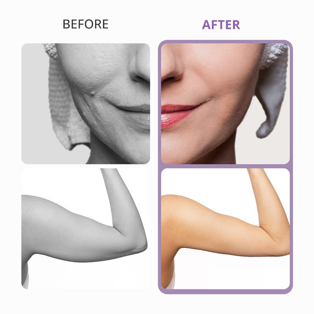 5 in 1 Beauty Machine for Body Massage Facial Skin Care Skin Lifting Lost WeigQ8