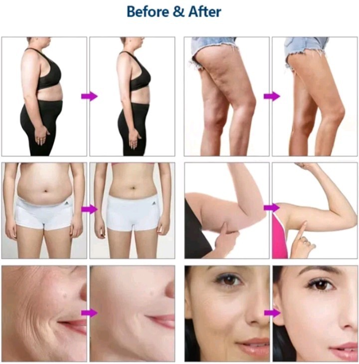 Body Cavitation Machine for Fat Removal 40k Ultra Slim Cavitation Machine