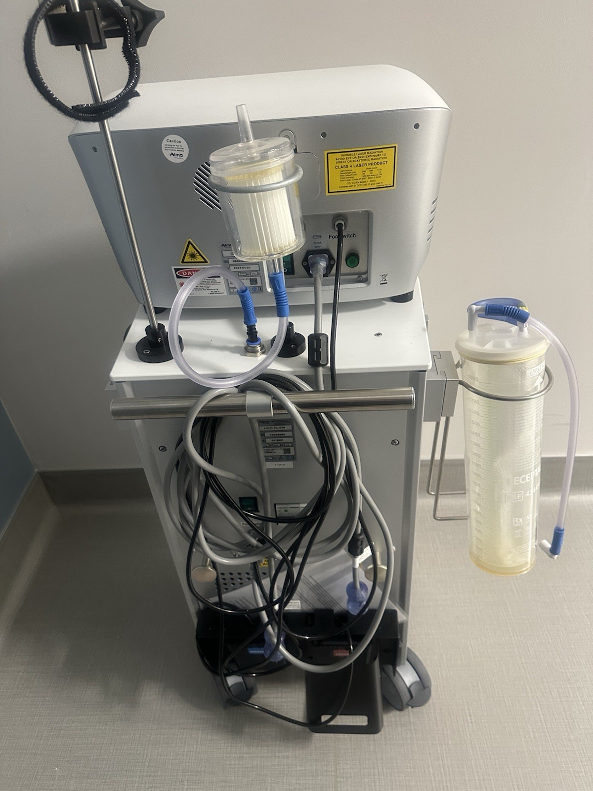 Alma Beautifill Laser Liposuction And Fat Grafting