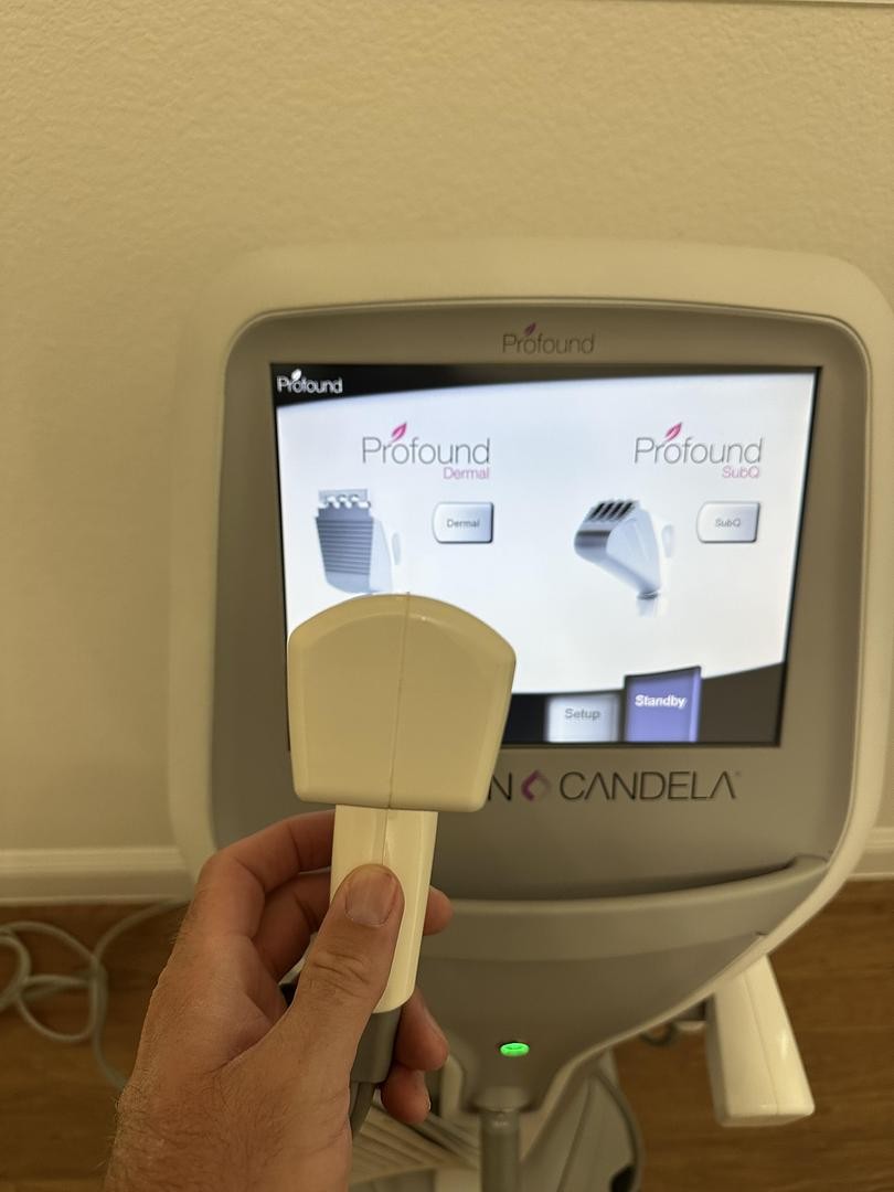 2011 Syneron Candela Profound RF Micorneedle