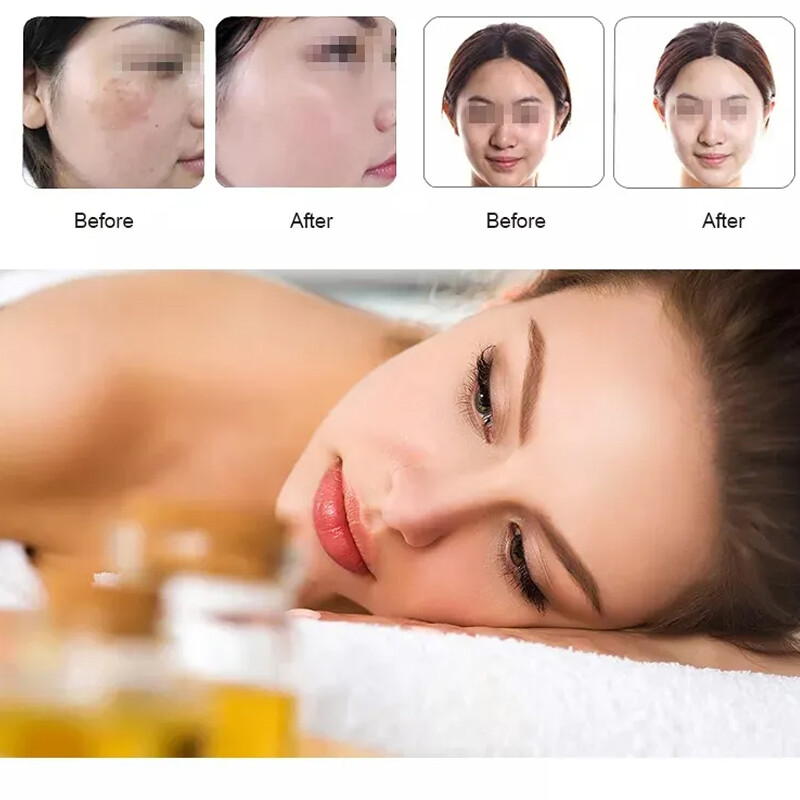 Hydro Dermabrasion Facial Machine Oxygen Spray Skin Rejuvenation Deep Cleansing
