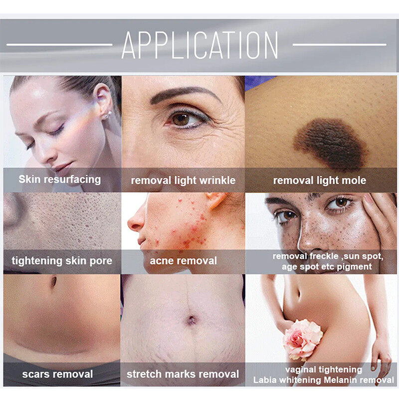 Skin Repair Laser Co2 Fractional Device Wrinkle Scar Removal Tightening