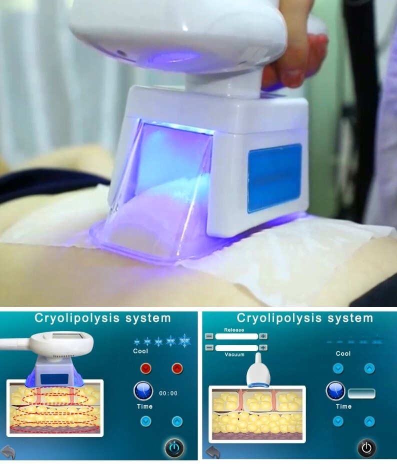3 Handles Cold Freezing Cool Body Chin, Double Chin Massage Beauty Machine
