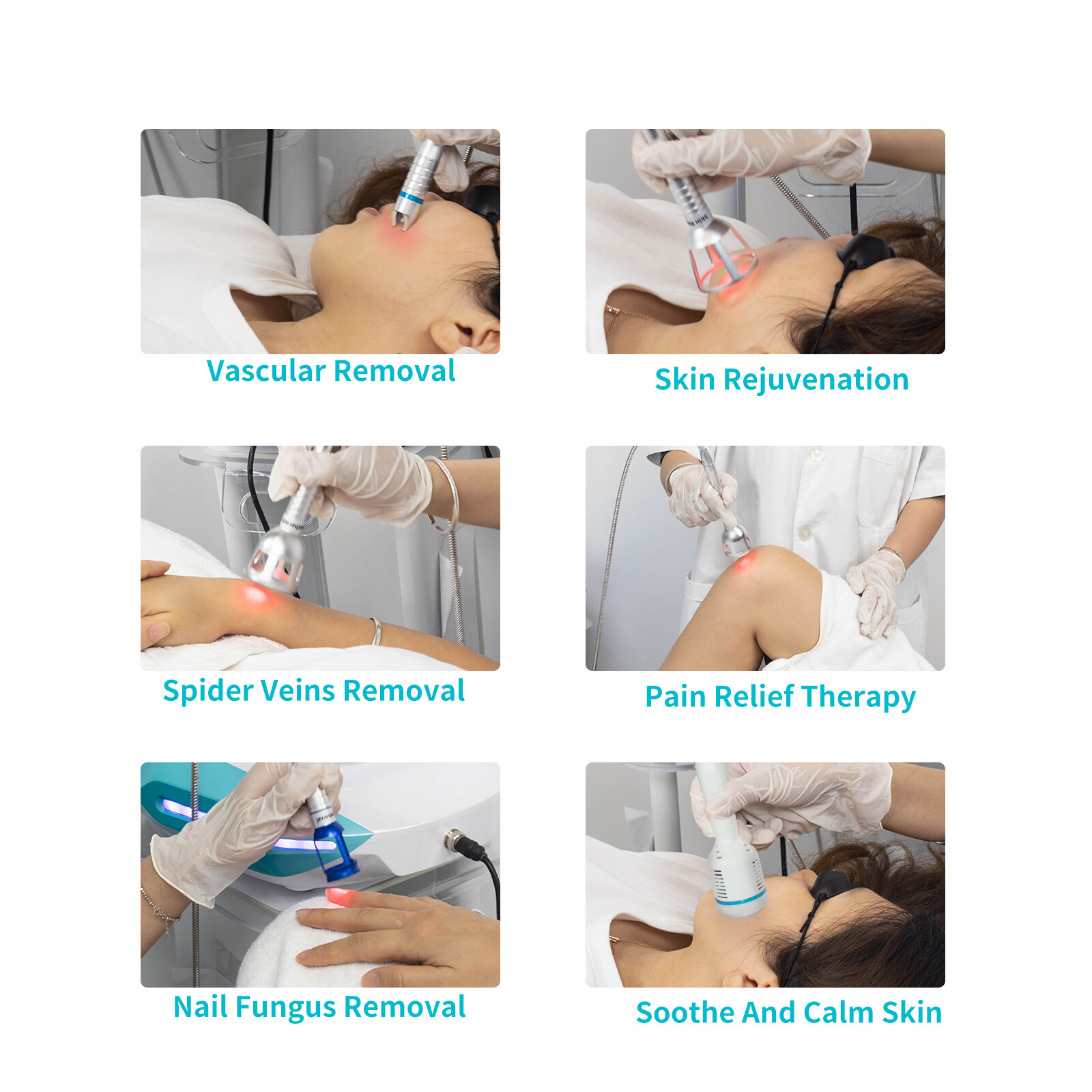 980nm Laser Device for Spider Veins, Nail Fungus Removal & Physical Therapy