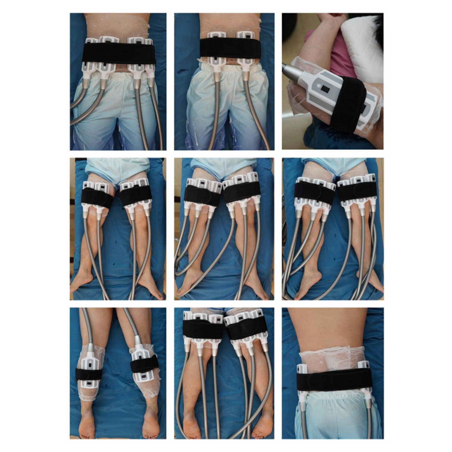 Body Shape Cryo Cool Fat Freezing Body Sculpting Slimming Machine Fat Removal