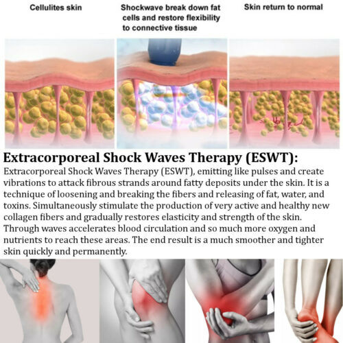 Home Use ED Treatment Pain Relief Physical Acoustic Shock Wave Therapy Machine