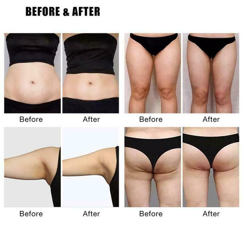 Proable Body Sculpting Weight Reduction Machine Muscle Stimulation Buttok Lift
