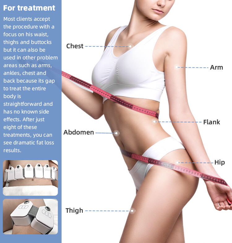 Trusculpt Flex 1mhz Bipolar Equipment Skin Tightening Treatment Cellulite Salon