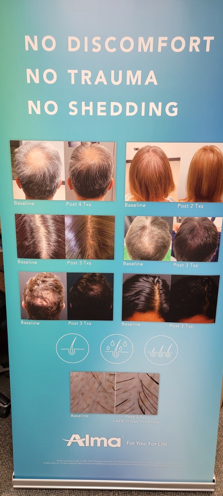 Alma TED Hair Restoration Machine, Cart Mounted, Cosmetology Use