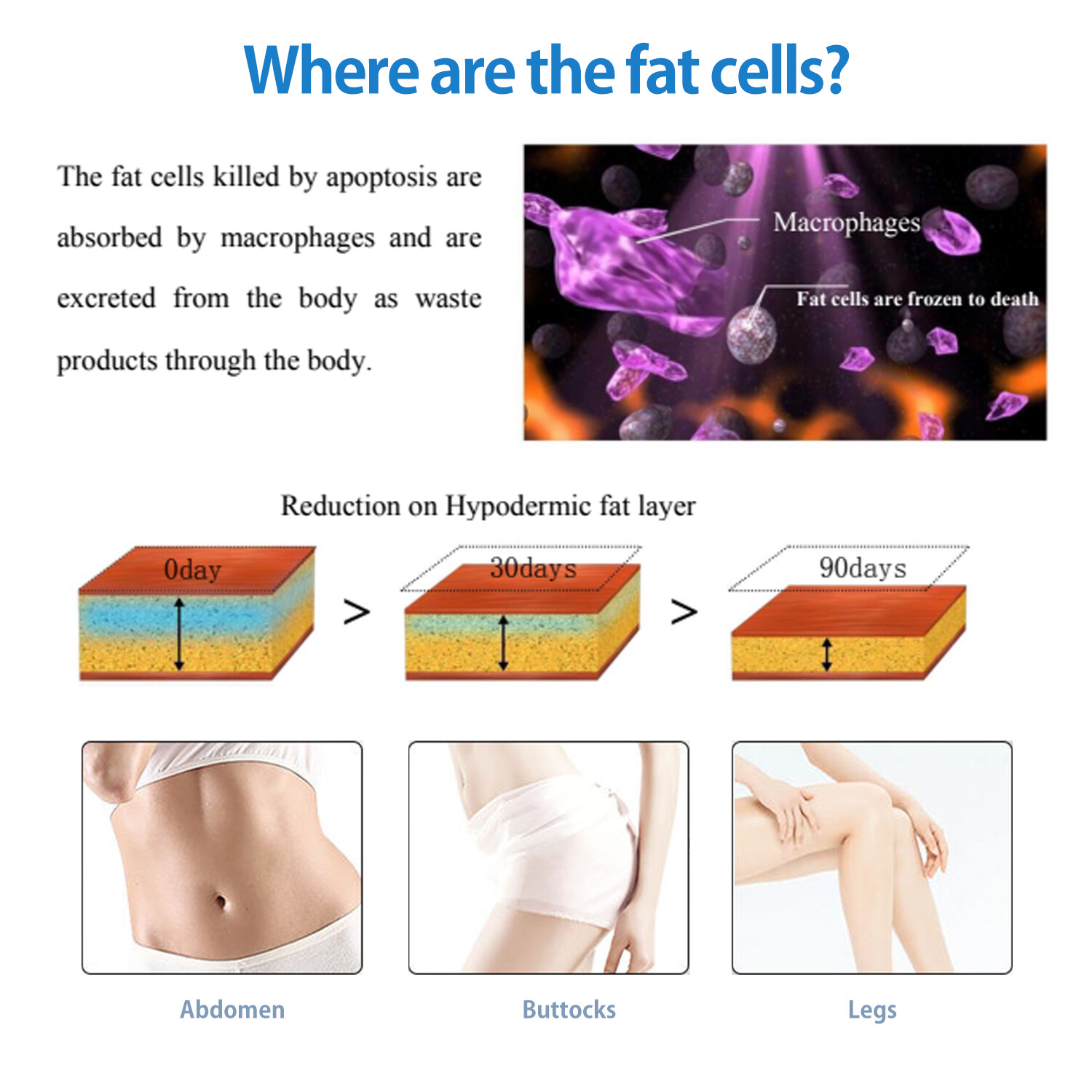 Body Shape Cryo Cool Fat Freezing Body Sculpting Slimming Machine Fat Removal