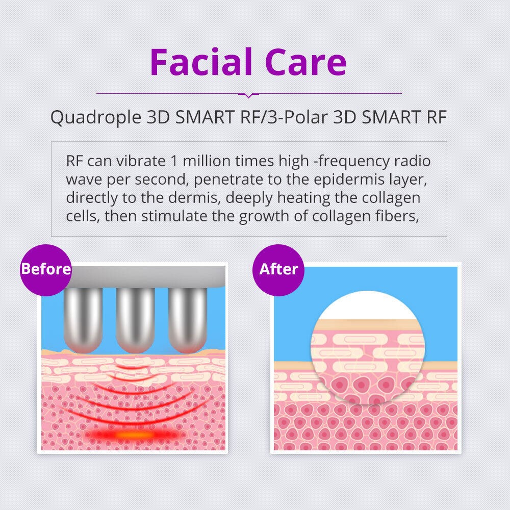 6 in 1 40K Ultrasonic Machine Cavitation Radio Frequency Cellulite Massage Skin
