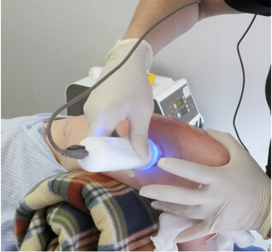 25mm PelleFirm Skin Tightening Handpiece by Ellman