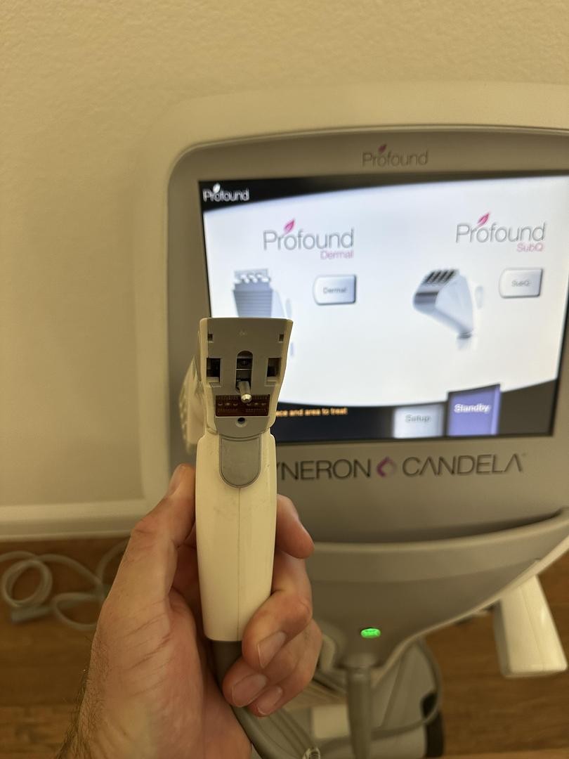 2011 Syneron Candela Profound RF Micorneedle