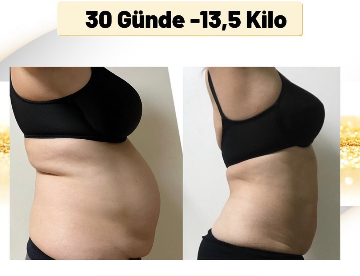 2025 TAIXL Body Shaping Massage Fat Removal Body Sculpt Build Muscles Machine