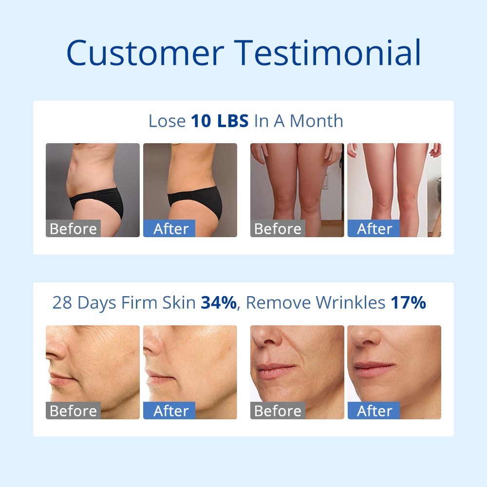 Premium 6 in 1 Beauty Machine for Skin Smoothing Enhance Body Curves With Cream