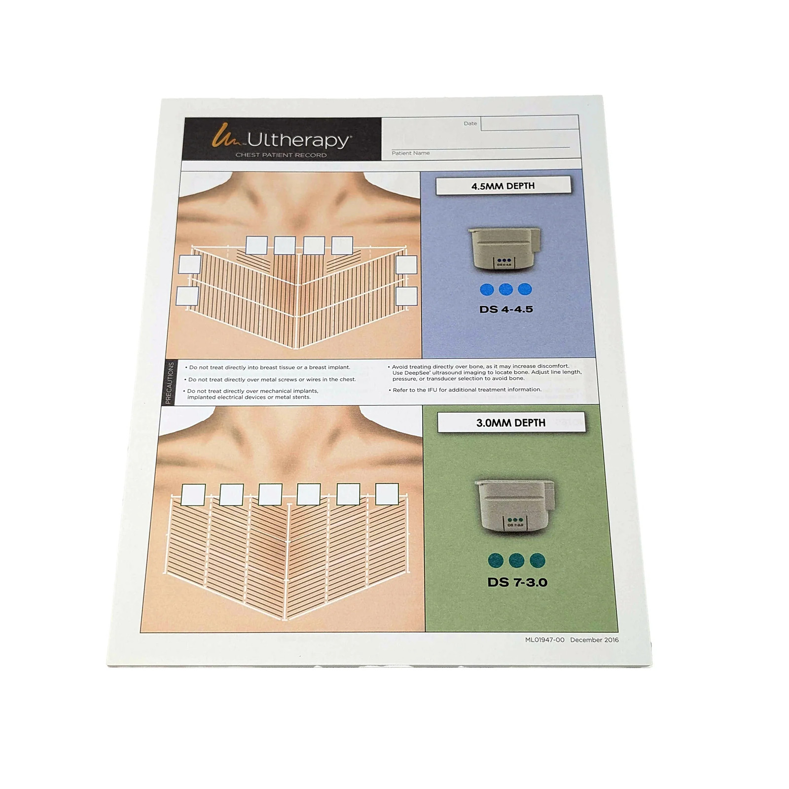 Merz Aesthetics Ultherapy Form “Chest Patient Record”