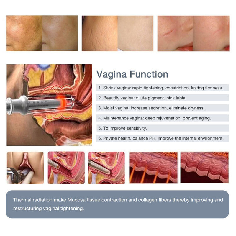 Skin Repair Laser Co2 Fractional Device Wrinkle Scar Removal Tightening