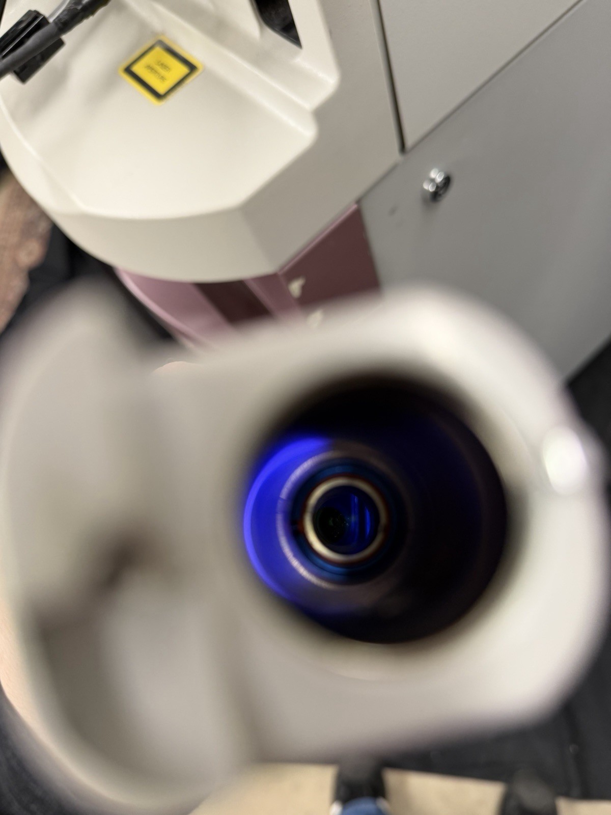 Candela VBeam Laser