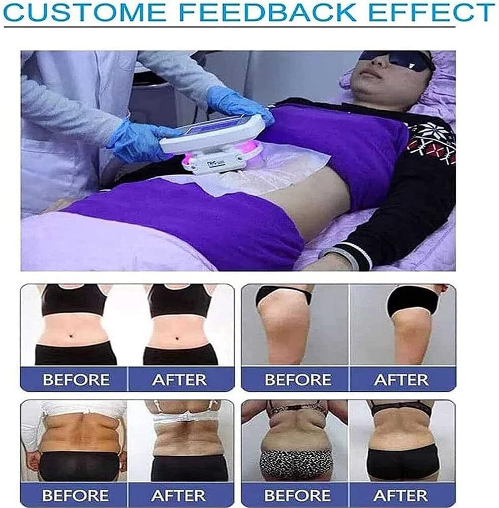 Body Sculpting Cryo therapy Fat Freezing Machine Loss Weight Skin Tightening