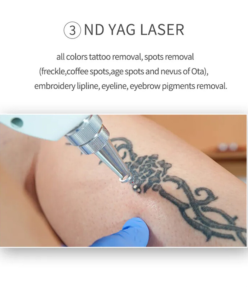 3IN1 ND YAG TATTOO REMOVAL IPL OPT Hair Removal Laser RF Skin Beauty Machine