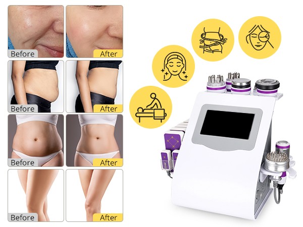 9-in-1 Beauty Machine for Body Massage Facial Skin Care Skin Lifting Lost WeigkY