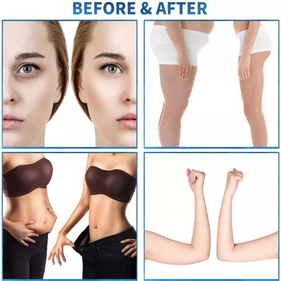 2IN1 Endo Body Massage Fat Reduce Lymphatic Drainage SKIN LIFTING Device