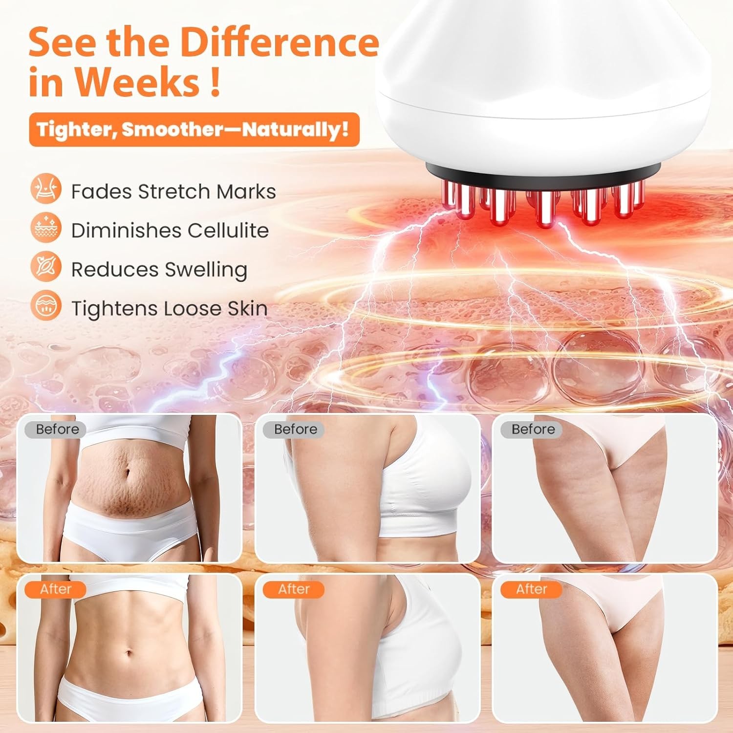 Body Sculpting Machine & Anti-Cellulite Massager: Rechargeable Lymphatic Drai…