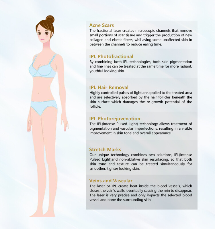 M22 IPL S-H-R OPT Laser Hair Removal Machine For Skin Whitening Anti-Aging Acne